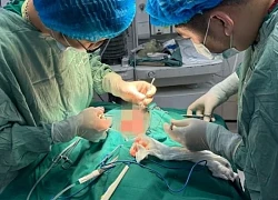 Xót xa bé 2 tuổi bị chó nhà nuôi tấn công phải nhập viện với nhiều vết thương phức tạp