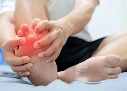 Các tác nhân phổ biến gây bệnh gout