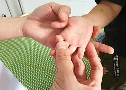 Gia đình, trường học chung tay phòng bệnh tay chân miệng
