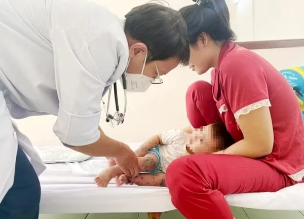Việt Nam thử nghiệm thành công vaccine tay chân miệng