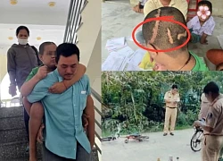 Vụ bé trai 7 lần mổ sọ: liệt nửa người bên phải, cha đèo con đến tòa làm 1 điều