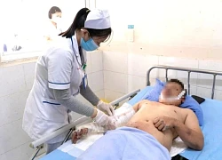 Vụ nổ lớn tại Công ty SGI Vina: Lời kể của nữ công nhân