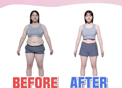 Ngoại hình giảm 30kg gây sốc của 1 cựu thực tập sinh hé lộ sự thật tàn khốc bên trong ngành công nghiệp giải trí