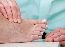 Người mắc tiểu đường, suy thận, gout nên ăn uống như thế nào?