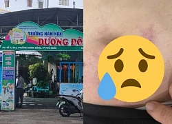 Vụ hiệu phó bị cấp dưới &#8216;tẩn&#8217; bầm tím: bị hại nắm bí mật sốc của người ra tay?