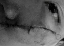Cháu bé co giật bất thường sau khi bị đánh bằng xẻng tại mái ấm ở TPHCM