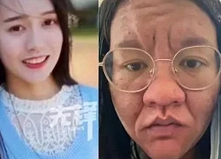 Khuôn mặt biến đổi khi mang thai của bà mẹ Trung Quốc gây sửng sốt