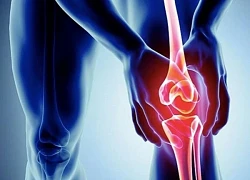 Thoái hóa khớp: Kẻ thù gây tàn phế