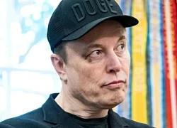 Tỷ phú Musk nêu lý do mắt bầm tím khi đến Nhà Trắng