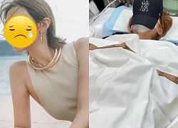 1 Hoa hậu bị mù tạm thời, nhập viện sau khi đắp mặt nạ dưỡng da, nguyên nhân sốc