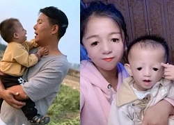Cô gái 'mặt chim' từng bị xa lánh, giờ sống ra sao sau khi sinh 2 con