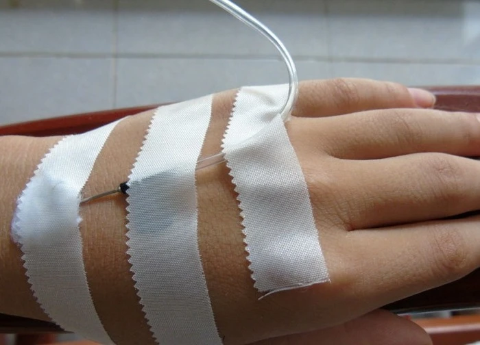 Có nên truyền dịch khi mắc sốt xuất huyết?