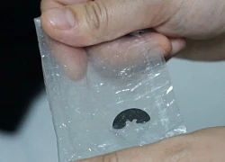 Cúc áo gãy đôi nằm trong đường thở bé gái 5 tuổi