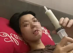 Hình ảnh cô gái mắc ung thư xương hàm, bữa ăn hàng ngày là "cháo xay loãng ăn bằng xi lanh" gây xót xa: Dấu hiệu phát hiện bệnh sớm trước khi quá muộn
