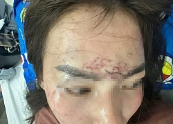 Khởi tố hai người phụ nữ vụ 'tra tấn' bằng axit và máy xăm