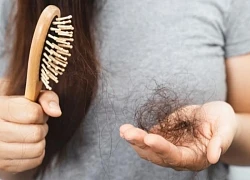 Tóc rụng nhiều sau sinh, ứng phó như thế nào?