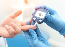 4 tác dụng phụ tiềm ẩn của kefir