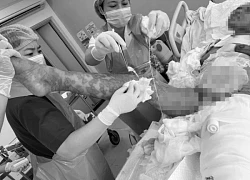 Bệnh viện Quân y 175 cứu nữ bệnh nhân bong tróc 92% da, thoát cửa tử thần