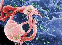 Đột phá khoa học có khả năng chữa khỏi HIV vĩnh viễn
