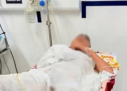Cố gỡ dây diều vướng đường điện cao thế, bé trai bị điện giật bỏng nặng