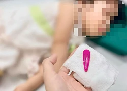 Hà Nội: Bé gái 21 tháng tuổi nhập viện sau khi nuốt một chiếc kẹp tóc kim loại