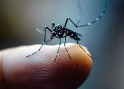 Triệu chứng sốt xuất huyết thay đổi thế nào khi tái nhiễm?