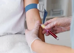 Khi nào tăng mỡ máu cần uống thuốc?