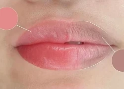 Nguyên nhân khiến môi thâm và cách khắc phục hiệu quả