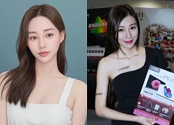 Sốc: 1 nữ người mẫu tử vong thương tâm sau khi đi trị liệu mất ngủ tại phòng khám thẩm mỹ