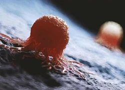 Xét nghiệm máu mới phát hiện ung thư trước khi có triệu chứng 3 năm