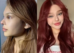 Hot TikToker "dao kéo" năm 16 tuổi, vừa lên bàn mổ lần thứ n, CĐM lắc đầu