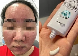 Tin kem chống nắng nổ trên mạng xã hội, mặt nữ sinh "nở hoa"