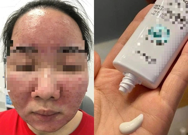 Tin kem chống nắng nổ trên mạng xã hội, mặt nữ sinh "nở hoa"