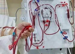 Cấp cứu sau nhiều ngày dùng nước tăng lực để ôn thi