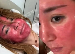 Khuôn mặt của người phụ nữ 22 năm không tẩy trang gây sốc