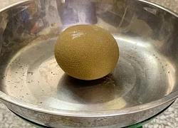 Lấy sỏi to như quả cam ra khỏi cơ thể người đàn ông