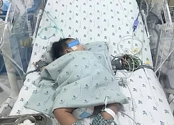 Nhiều trẻ em sốt xuất huyết Dengue nặng, có trẻ mất máu ồ ạt