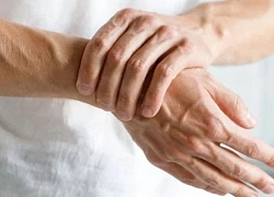 Dấu hiệu ở tay chân cảnh báo axit uric cao