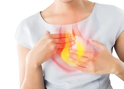 Nguyên nhân gây ợ nóng và cách khắc phục