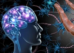 Sương mù não: tín hiệu cảnh báo sức khỏe trí não