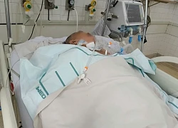 TP Hồ Chí Minh: Gia tăng ca viêm não do zona thần kinh