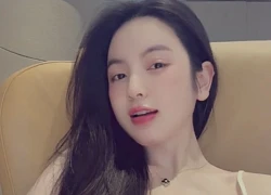 "Cam thường" soi rõ Chu Thanh Huyền với cằm tím tái hậu "trùng tu" nhan sắc, ra sân cổ vũ Quang Hải gây chú ý