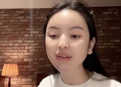 Chu Thanh Huyền kể lại trải nghiệm kinh hoàng khi đi xử lý hậu quả phẫu thuật thẩm mỹ