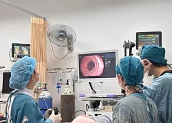 Nam thanh niên bị thủng manh tràng do nuốt phải tăm tre
