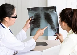 Phổi bị tàn phá bởi một thói quen không ngờ đến
