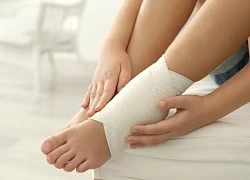 Biểu hiện của bong gân khớp cổ chân