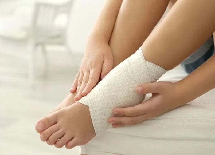 Biểu hiện của bong gân khớp cổ chân