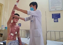 MS 1016: Mong một phép màu cho na.m sin.h bị bỏng điện cao thế 55% cơ thể