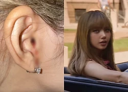 Lisa bị thương, chả.y má.u ở tai, Concert BLACKPINK có thể chỉ còn 3 người diễn?