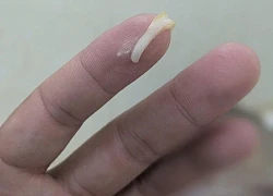 Nam thanh niên 'nuôi' sán dây dài 3 mét vì mê ăn loại rau quen thuộc